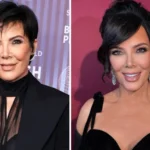 kris jenner before and after facelift