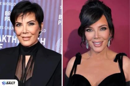 kris jenner before and after facelift
