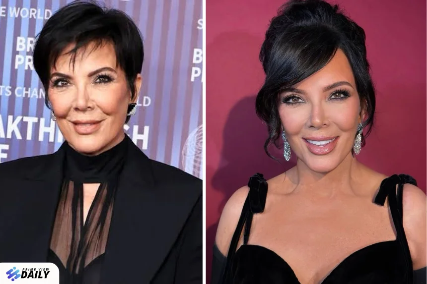 kris jenner before and after facelift